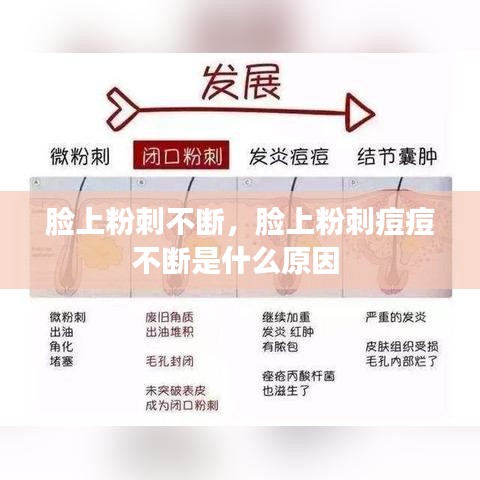 脸上粉刺不断，脸上粉刺痘痘不断是什么原因 